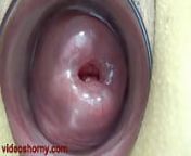 Uterus Penetration with Objects, Pumping Cervix Prolapse from www stim 99 com porn xxx video