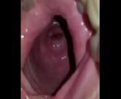 Wide open pussy low cervix from vagina open