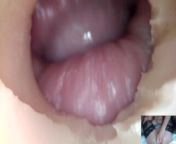 Andrada endoscope pussy fuck - 10 10 from downloads www my punjab village sex
